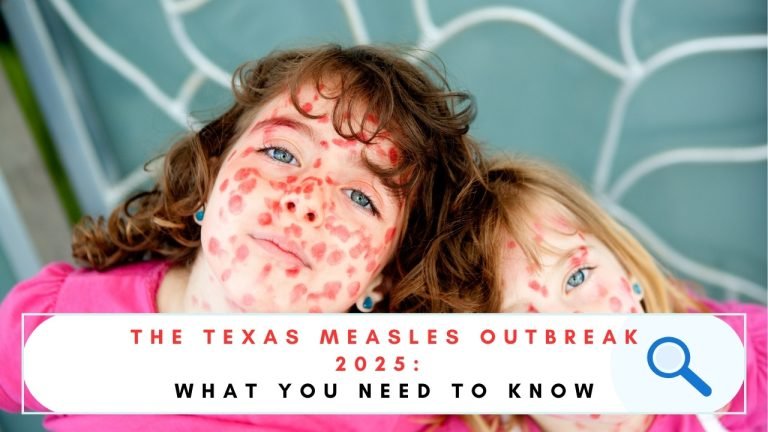 The Texas Measles Outbreak 2025: What You Need To Know! - Discovery ...