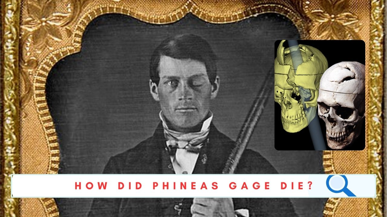 How Did Phineas Gage Die The True Story Behind His Final Years